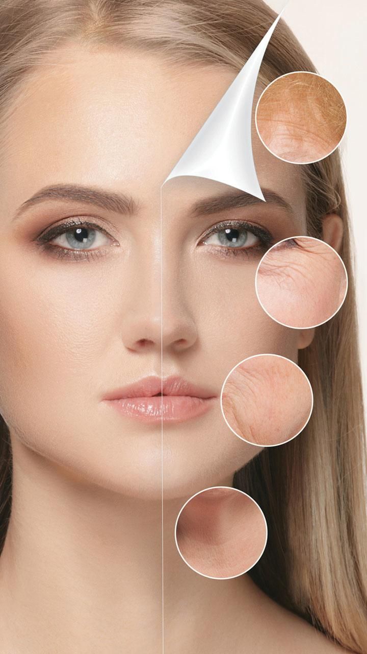 Jawtox (Masseter Botox)